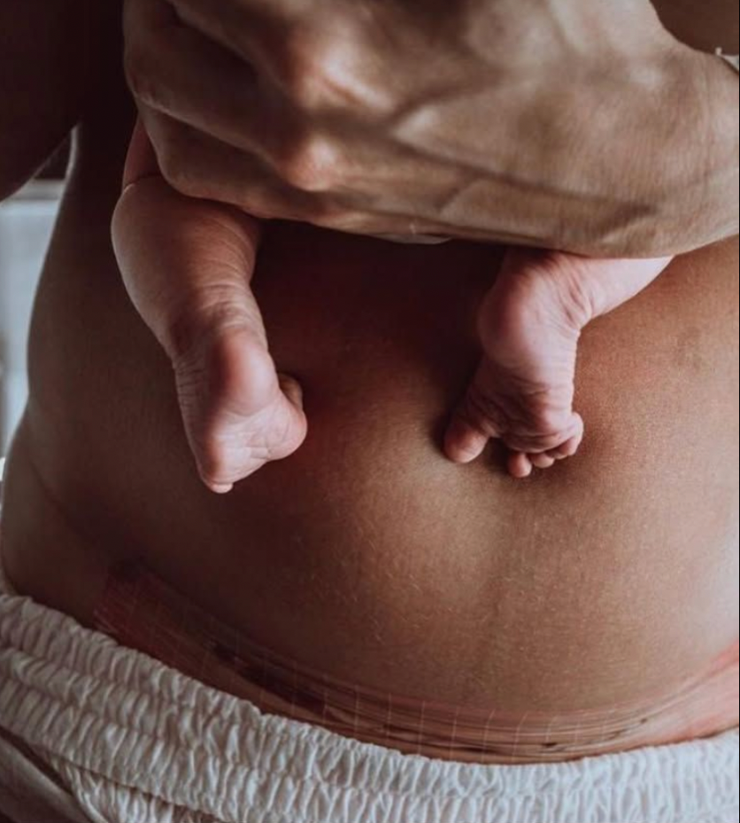 Consulta Plan de Parto