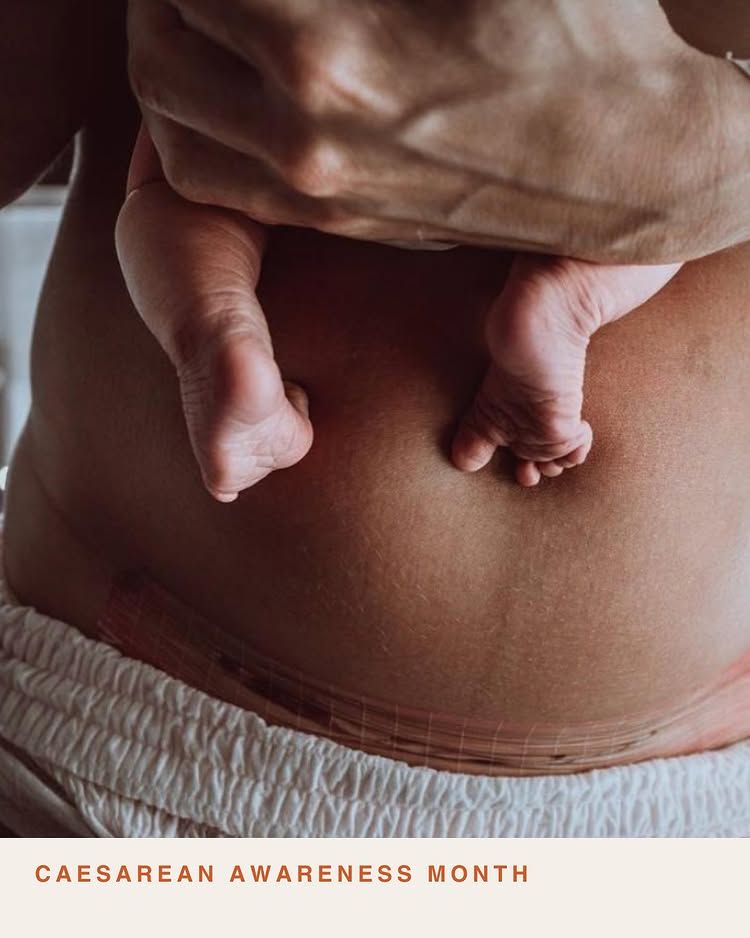 Consulta Fertilidad - Telemedicina