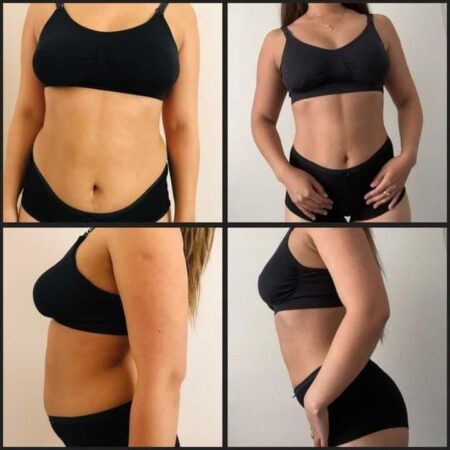 ✨Gimnasia hipopresiva